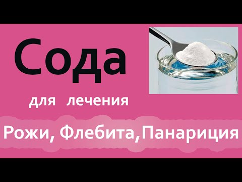 Видео: Компресс и обертывания из СОДЫ. ЛЕЧЕНИЕ рожи, панариция, флебита.