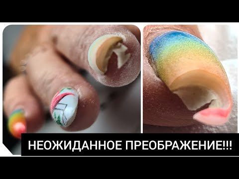 Видео: УБЕРИ это НЕМЕДЛЕННО ///  AGENT nail