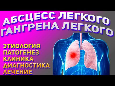Видео: Абсцесс легкого и гангрена легкого. Лекция по пульмонологии.