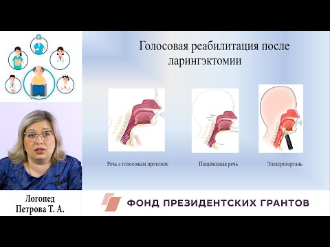 Видео: Восстановление голоса у онкологических пациентов перенёсших ларингэктомию