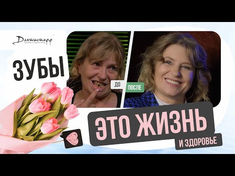 Видео: ЗУБЫ это ЖИЗНЬ и здоровье! → #имплантациязубов #зубныепротезы