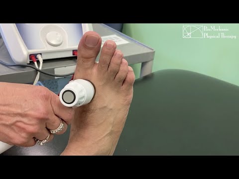 Видео: Это торфяной палец или шишка? АКА Hallux Limitus, Hallux Hardus