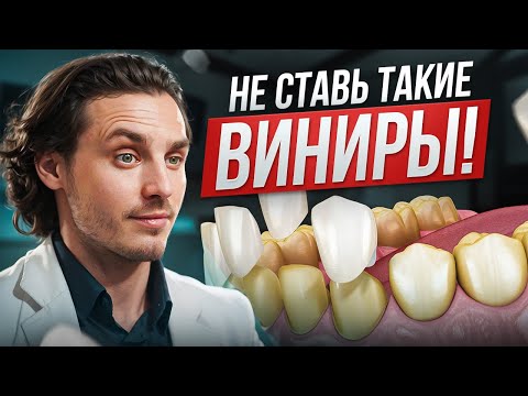 Видео: 5 причин НЕ ставить виниры! Почему виниры могут быть ОПАСНЫ?