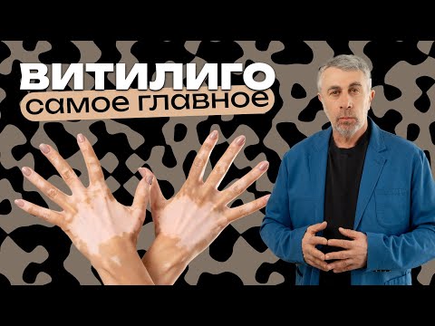 Видео: Витилиго. Самое главное