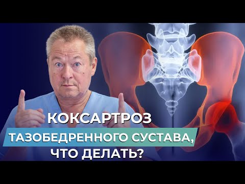 Видео: МЕНЯТЬ СУСТАВ НЕТ СМЫСЛА? Что делать при КОКСАРТРОЗЕ ТАЗОБЕДРЕННОГО СУСТАВА?