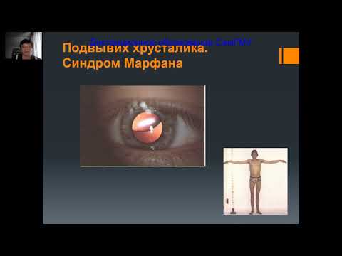 Видео: Катаракта Часть 1