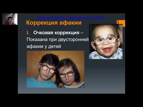 Видео: Катаракта Часть 2