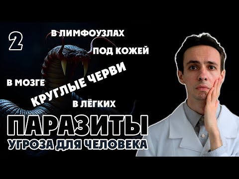 Видео: Паразиты, которые скрываются в мозге, мышцах, лёгких, лимфе и под кожей. В опасности каждый!