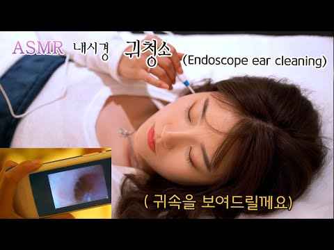 Видео: ASMR установил очистительную систему в Китае. Endoscope ear cleaning Full ver.