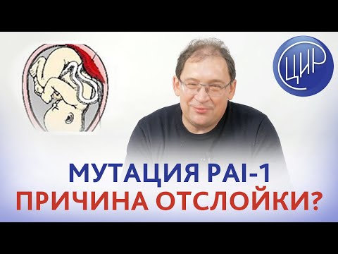 Видео: Отслойка плаценты. Может ли быть отслойка плаценты из-за мутации PAI-1? Отвечает Гузов И.И.