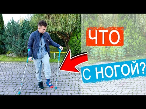 Видео: ВЛОГ: Сломал ногу? | Миша приехал на костылях |  4.11.20