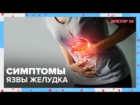 Видео: Симптомы ЯЗВЫ желудка | Доктор 24