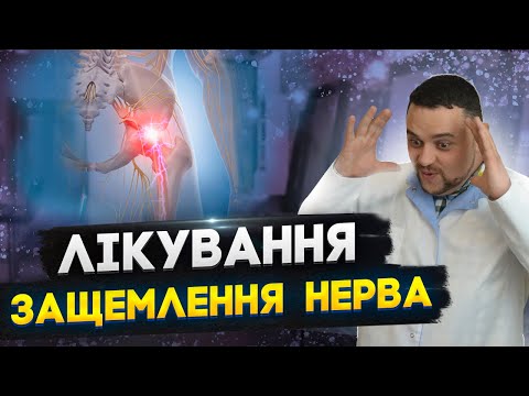 Видео: Защемлення сідничного нерва. Лікування.