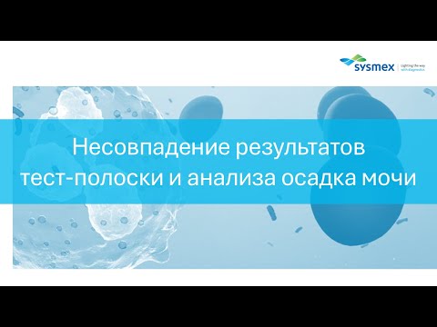 Видео: Несовпадение результатов тест-полоски и анализа осадка мочи