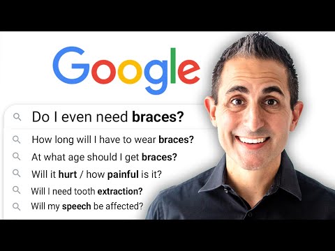 Видео: 5 вопросов, которые все задают себе в Google перед установкой брекетов