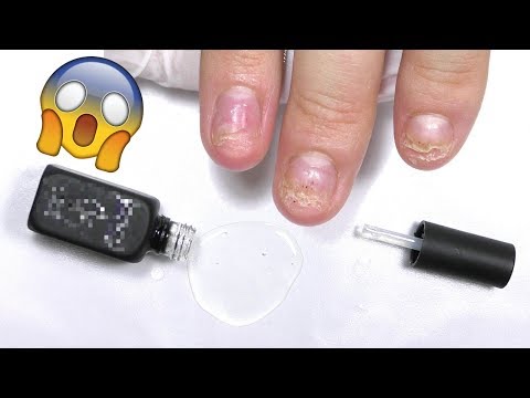 Видео: Опасные материалы 🔥База для гель-лака сожгла ногти