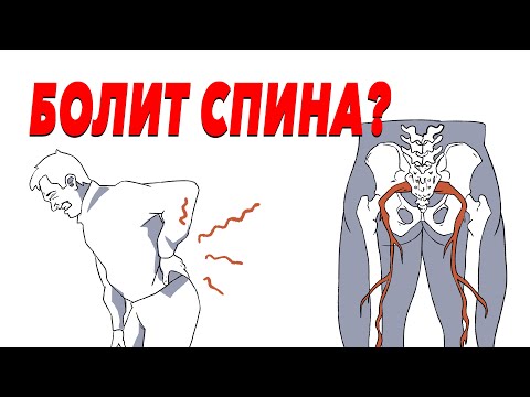 Видео: Прихватило спину? Что делать В ПЕРВУЮ ОЧЕРЕДЬ