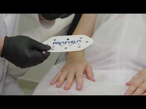 Видео: Сочетание хемоэксфолиации Enerpeel Hands и ремоделирования кожи Profhilo Body в области кистей рук
