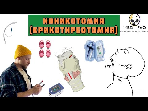 Видео: Коникотомия (крикотиреотомия)