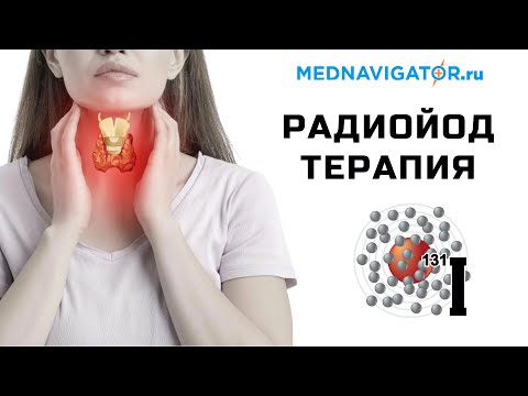 Видео: РАДИОЙОДТЕРАПИЯ ЩИТОВИДНОЙ ЖЕЛЕЗЫ - показания, возможности, до и после процедуры | Mednavigator.ru