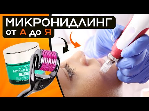Видео: Эта процедура ВЕРНЕТ МОЛОДОСТЬ! Фракционная мезотерапия для ЗДОРОВЬЯ кожи