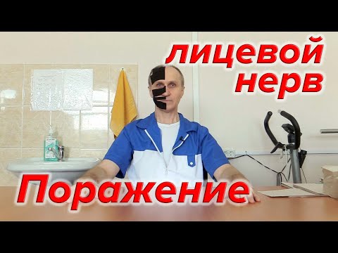 Видео: Поражение лицевого нерва.