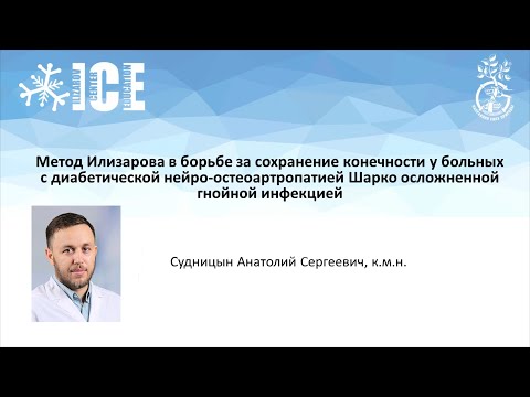 Видео: Метод Илизарова в лечении  больных с диабетической нейро-остеоартропатией Шарко с гнойной инфекцией.