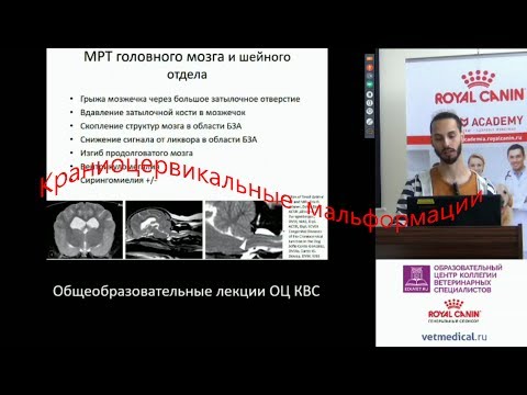 Видео: Субботин А. С. - Краниоцервикальные мальформации