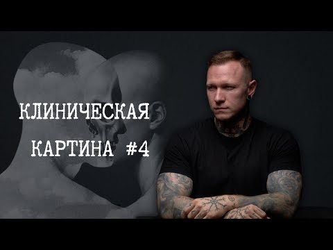 Видео: Социальная тревога и социальная фобия - в чем разница/Психопат за рулем/Клиническая картина №4