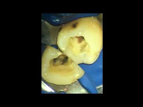 Видео: 2021-03-04 Просто так ни о чем