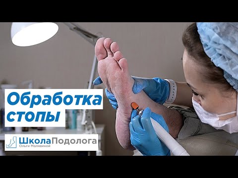 Видео: Обработка стопы. Аппаратный педикюр. Мастер класс.