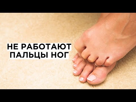 Видео: Не работают пальцы ног? Хотите здоровые стопы?