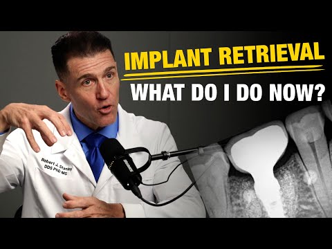 Видео: Как удалить зубной имплант
