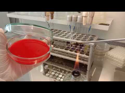 Видео: Лабораторная диагностика стрептококковых инфекций