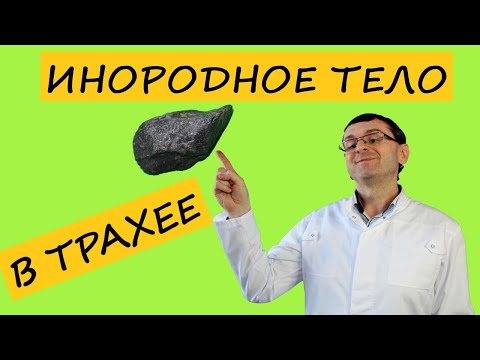 Видео: Инородное тело в трахее