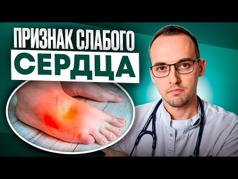 Видео: 7 ПРИЗНАКОВ СЛАБОГО СЕРДЦА. Предотврати сердечную недостаточность, пока не поздно