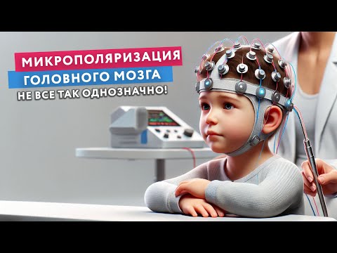 Видео: Микрополяризация головного мозга: плюсы и минусы