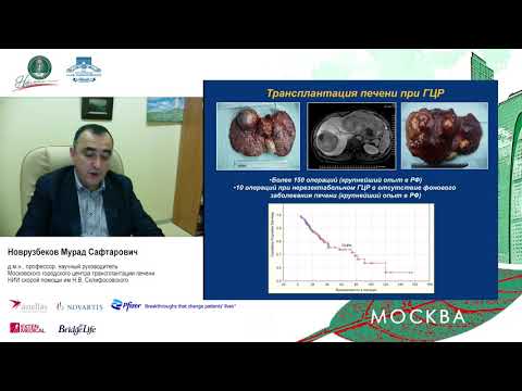 Видео: D1. Московский городской центр трансплантации печени - 25 лет опыта