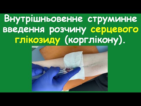 Видео: 19. Внутрішньовенне струминне введення розчину серцевого глікозиду (корглікону).