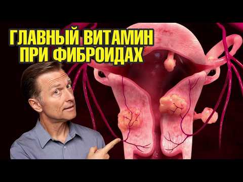 Видео: Миома матки: этот витамин поможет уменьшить миому🧐Доказано!