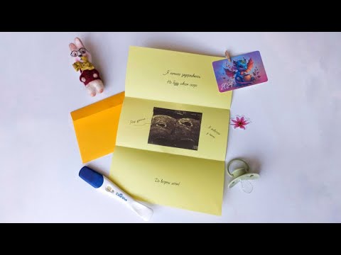 Видео: Победный протокол | что помогло забеременеть | история бесплодия