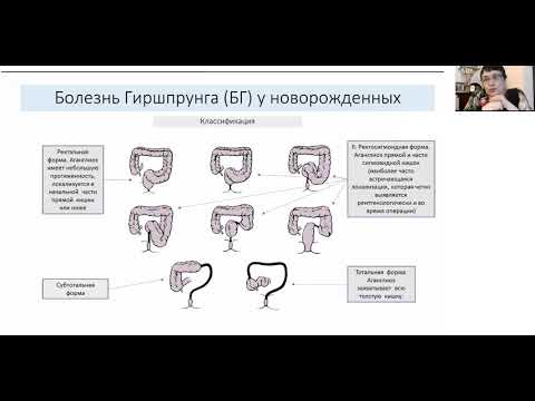 Видео: Школа клинического мышления педиатра. Болезнь Гиршпрунга. Клинический случай