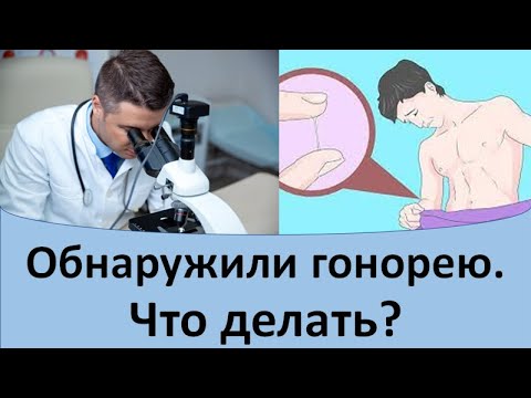 Видео: Обнаружили гонорею.  Что делать?