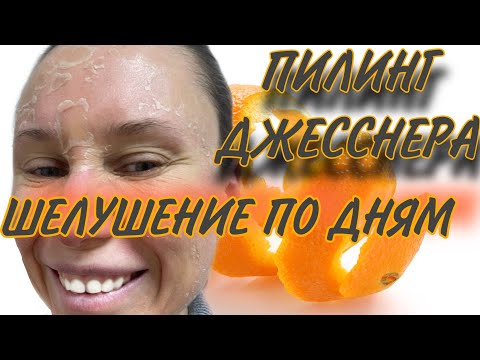 Видео: ПИЛИНГ ДЖЕССНЕРА. КАК ШЕЛУШИТСЯ ПО ДНЯМ/КАК УСПОКОИТЬ КОЖУ ПОСЛЕ ПИЛИНГА.