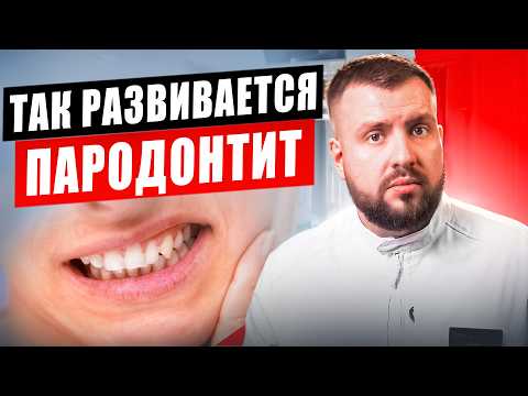 Видео: Почему зубы выпадают, даже если всё делаешь правильно?