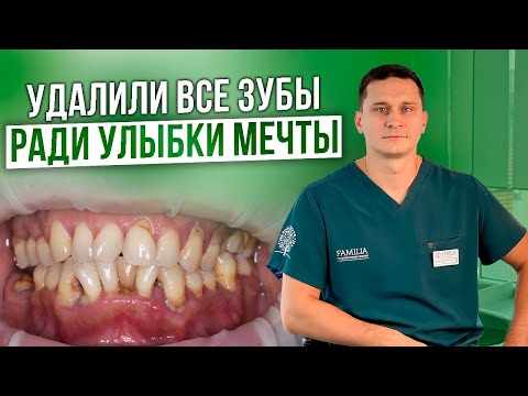 Видео: Удаление 27 зубов одномоментно! / История Улыбки