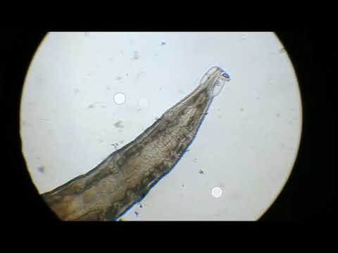 Видео: микроскопия кала #копрограмма