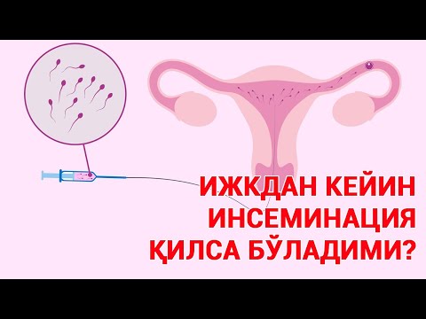 Видео: ИЖКдан кейин инсеминация қилса бўладими? #doctorYakubjonov