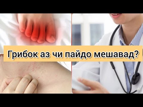 Видео: Грибок аз чи пайдо мешавад? Табобаташ чи гуна аст #хаётисолим #грибок #табобат