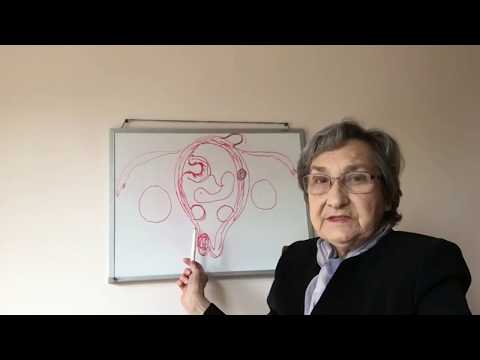 Видео: Миома матки, опухоли яичников, беременность и роды (54)